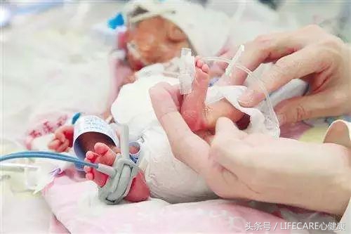 先心病宝宝术后怎么护理,先心病儿童术后关注事项