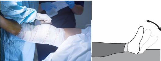 膝关节置换后肿胀可用盐袋热敷吗,膝关节置换50天仍然肿胀吃什么药