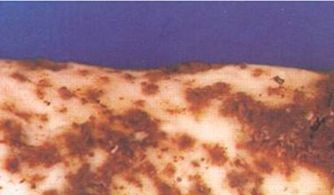 山药红斑是如何形成的,山药红斑病