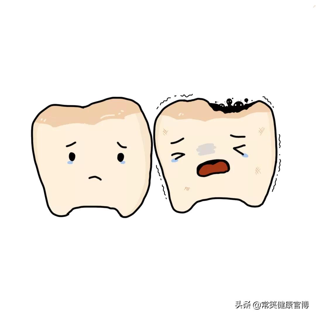 每天认真刷牙为什么会有牙菌斑,每天认真的刷牙牙还是在坏怎么办