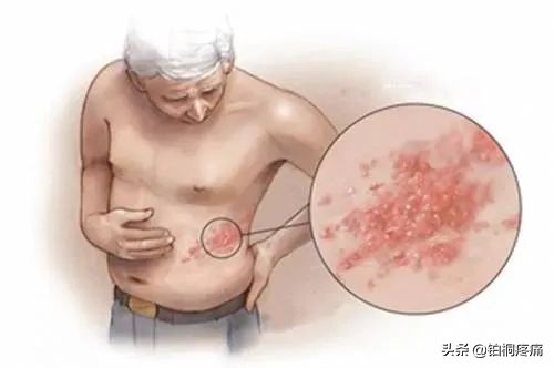 身体再疼也要忍着,哪些病症需看疼痛科