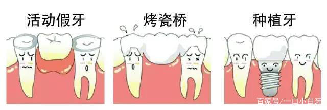 大熊猫戴牙套,大熊猫的牙齿能不能矫正