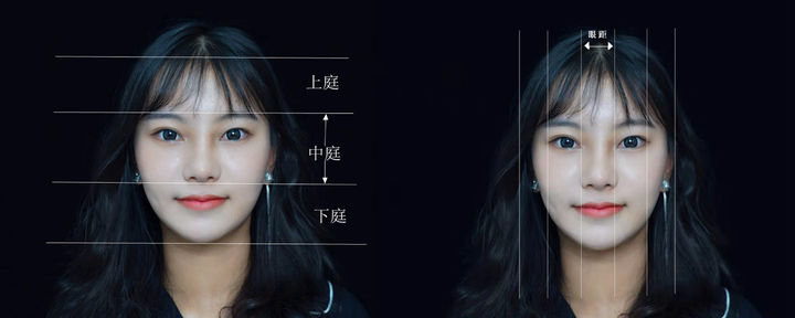 开外眼角会有哪些后遗症,开外眼角的手术后的图片