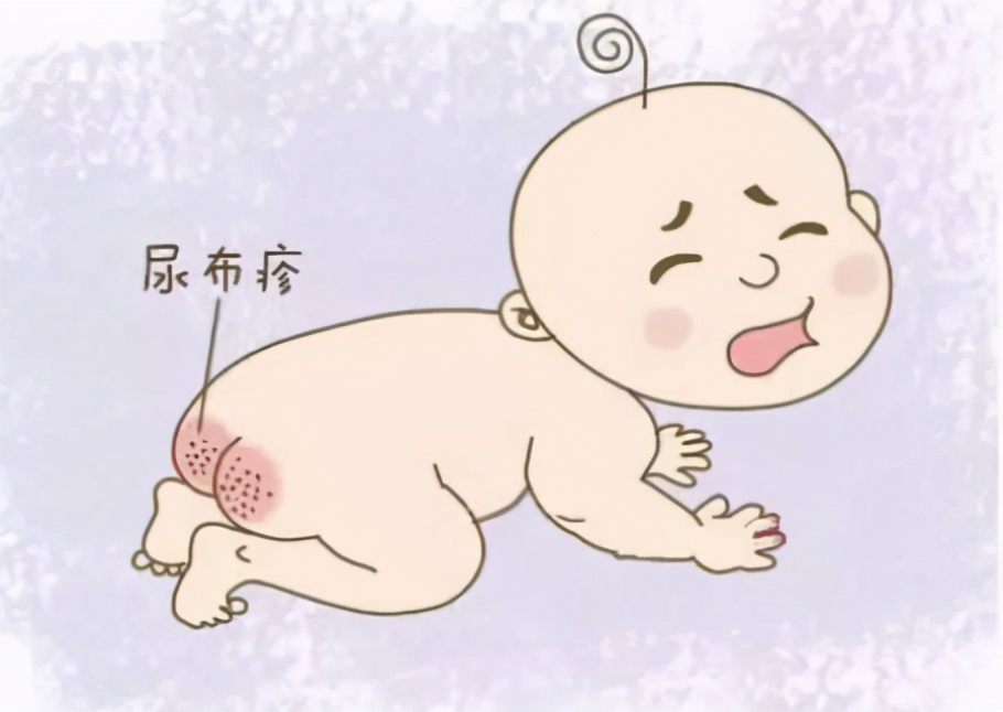 美力源育儿讲堂：宝宝总是会出现红屁股怎么办