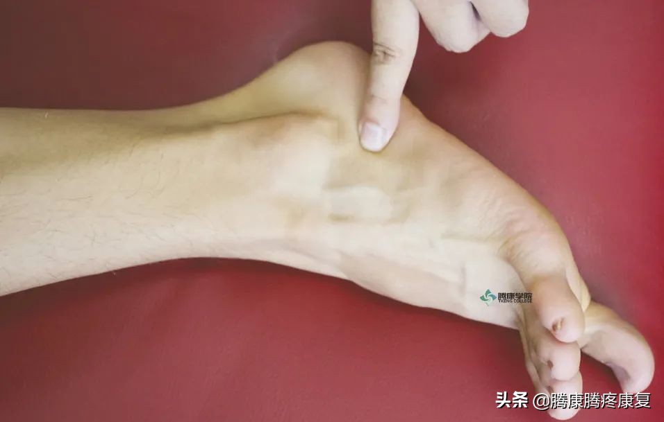 足外翻如何按摩腓骨长肌儿童,足外翻怎样调整腓骨长肌