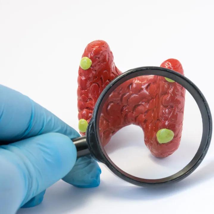 识别“百变”甲亢——中医药防治甲状腺疾病系列科普之一