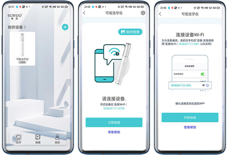 智能可视超声波洁牙仪洗牙步骤,牙科用的超声波洁牙设备