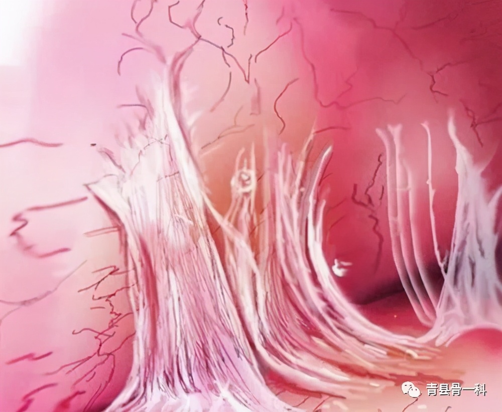 手指肌腱断裂怎么连接,小指第一节肌腱断裂肌腱粘连症状