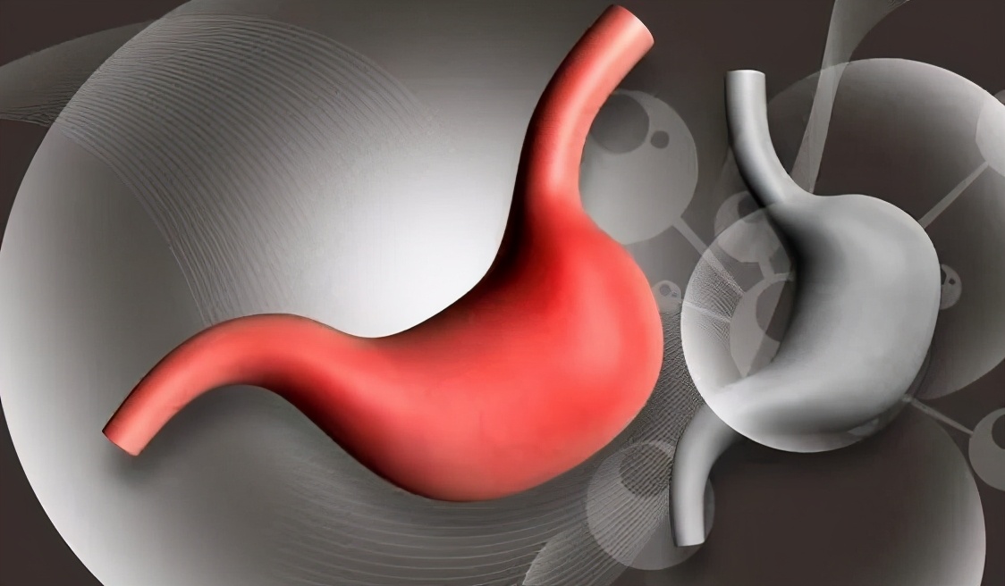 慢性糜烂性胃炎要关注什么,糜烂性胃炎需要多长时间才能治愈