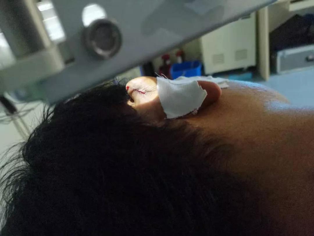 肿瘤放射治疗技术袖珍指南,肿瘤放射治疗技术改版