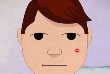 三招教你搞定痘痘肌,教你三招小技巧轻松解决痘痘烦恼