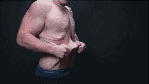 皮肤严重松弛衰老30岁看着像60岁,皮肤松弛的人老了是什么样的