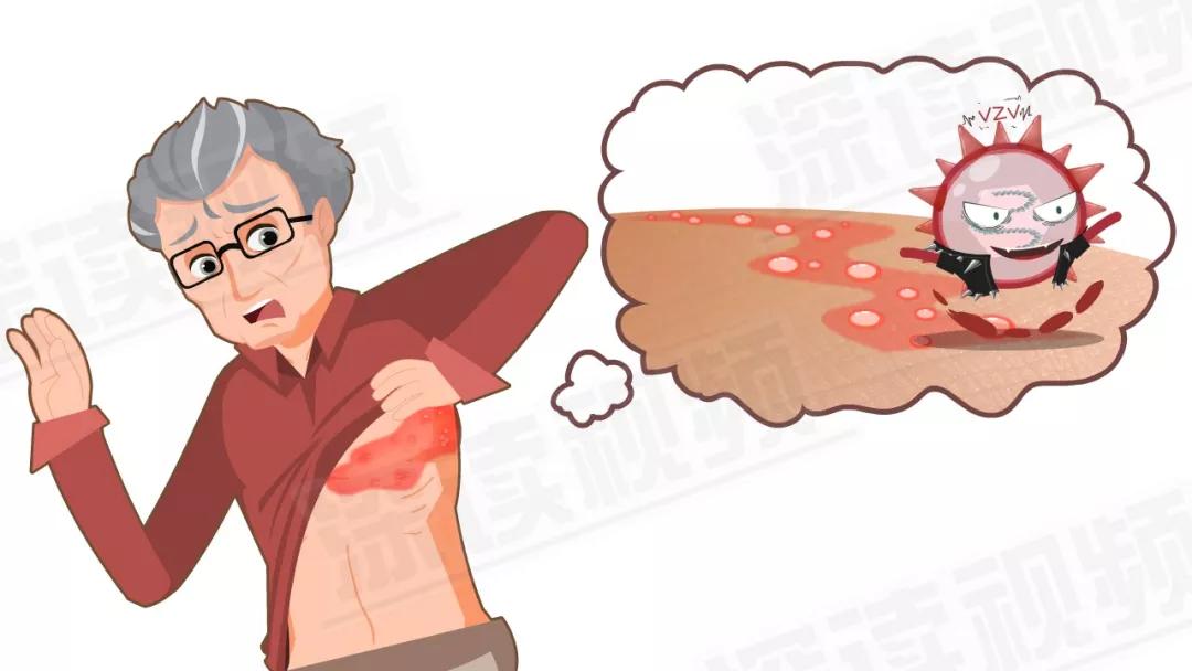 老太太为治病信偏方，剃光头发满脸涂墨汁！这病疼起来堪比生娃