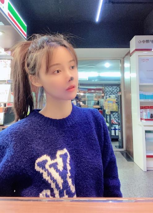 95后整容女演员,高溜整容失败案例