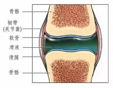 骨科大夫谈关节积液怎么处理,关节有积液怎么治疗才能彻底根除