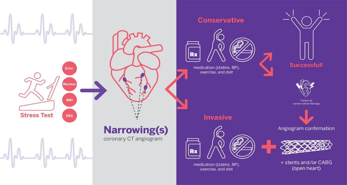 冠心病微血管病变怎么控制,稳定型冠心病的最佳治疗方案