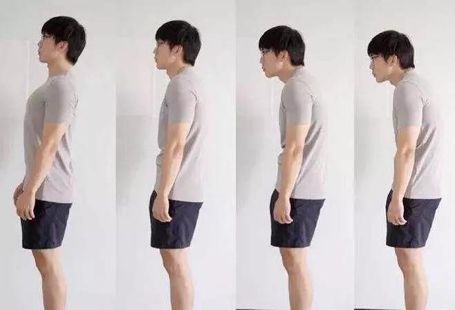 刘亦菲发腮什么意思,发腮的原因找到了