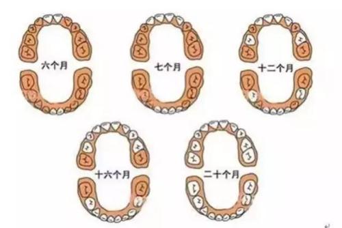 宝宝开始出牙需要关注什么,宝宝出牙顺序有什么