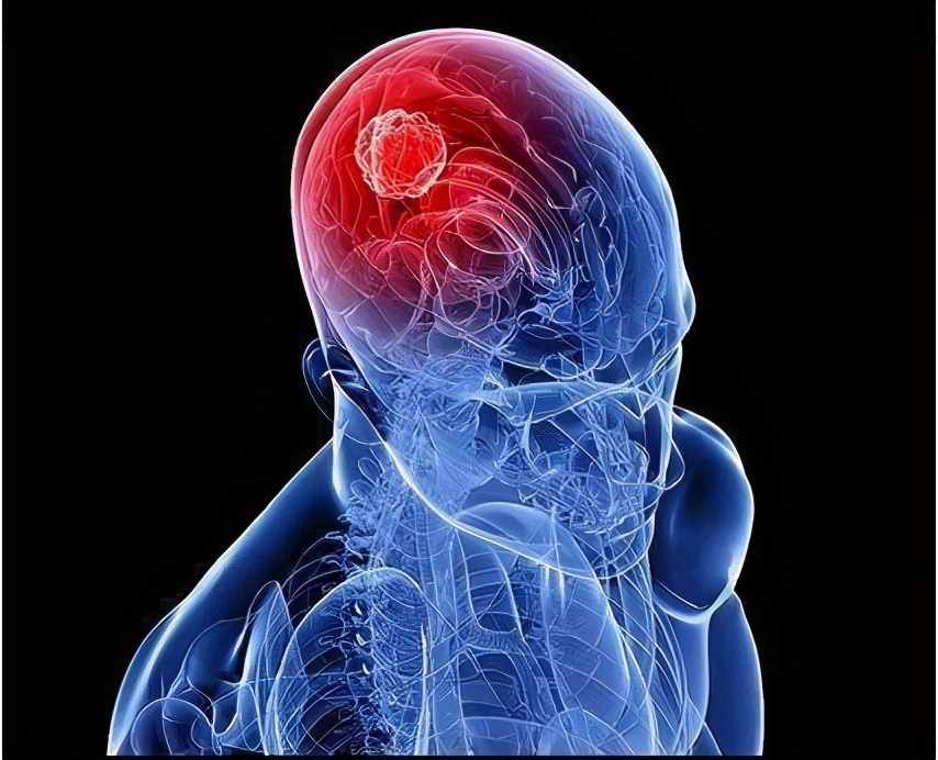 腹腔室间隔综合征疾病分类,腹腔室间隔综合征病情询问