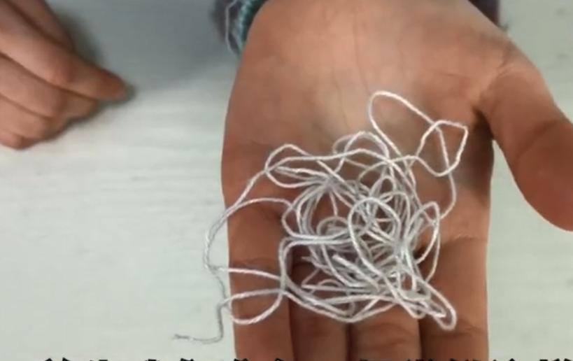 戒指取不下来别着急一招轻松解决,戒指戴手上肿胀取不下来怎么办