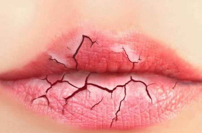 脸上死皮怎样去,脸上去死皮小妙招