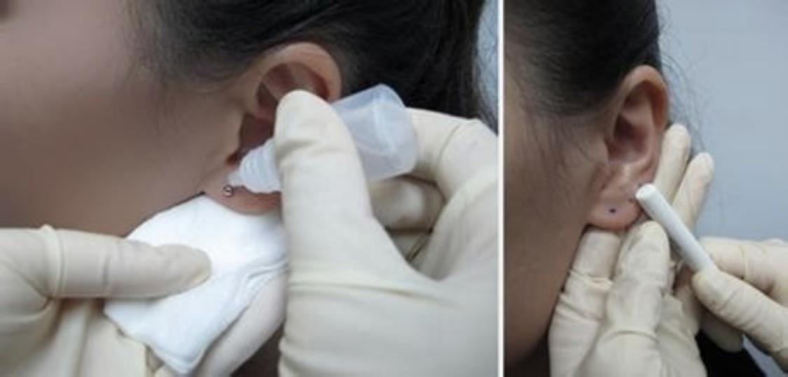 打耳洞竟差点瘫痪？关于耳洞，这些细节你一定要知道