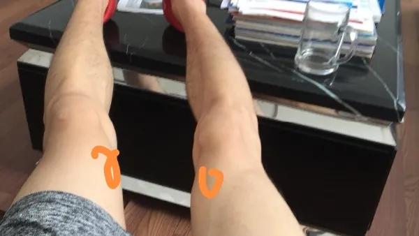 治疗跑调的方法,跑伤的正确处理方法