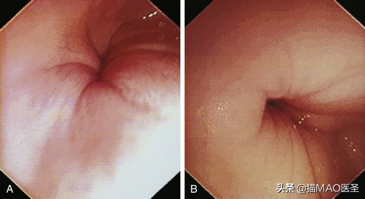 犬猫内窥镜检查气管食道,猫狗内窥镜