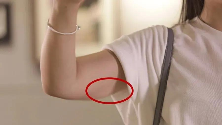 蝴蝶袖减不掉的原因,如何告别蝴蝶袖