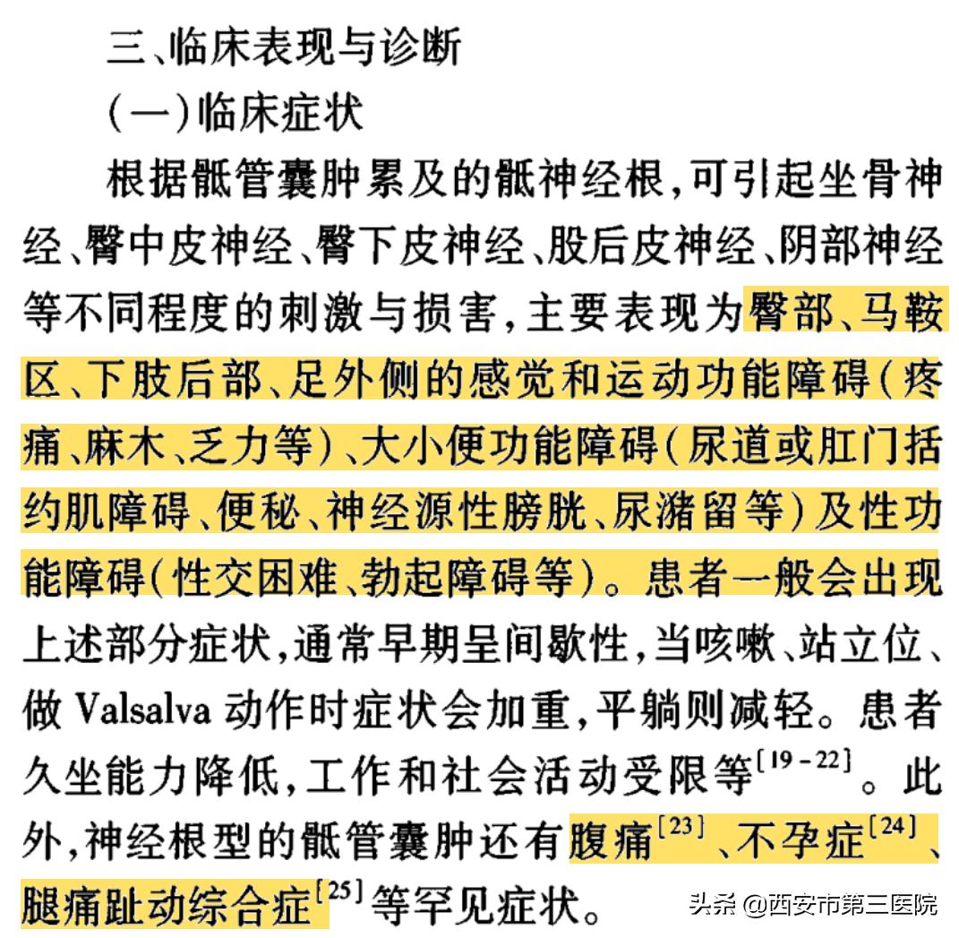 【医者解读】揭开“骶管囊肿”之神秘面纱，查出骶管囊肿都需要治疗吗？（手术病例+文献回顾）