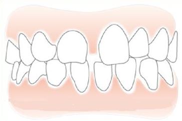 心态崩了觉得自己很差,心态崩了对身子有什么影响
