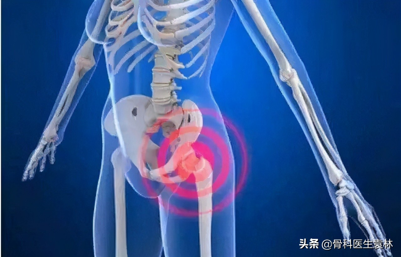 骶髂关节炎是骨质炎症引起的吗,骶髂关节炎是什么原因引起的