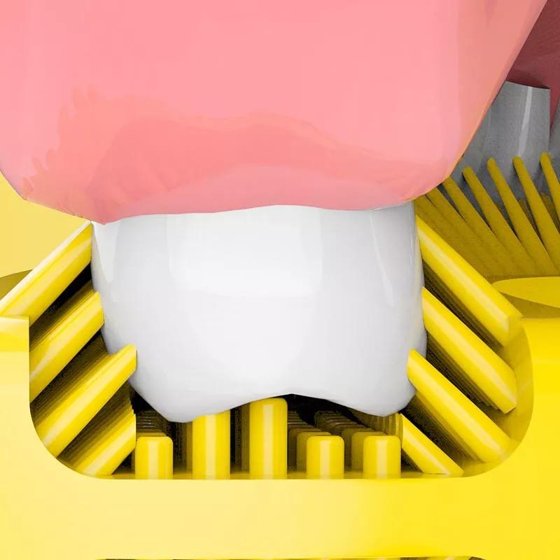 3岁儿童蛀牙疼的天天晚上哭,小朋友3岁半一直蛀牙