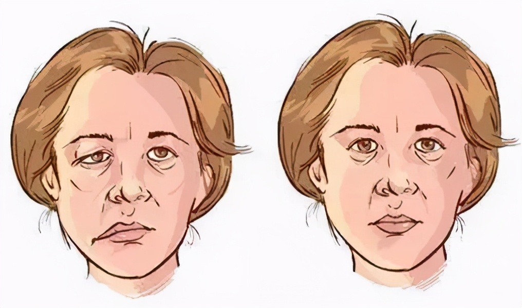 怎么突然嘴凸了,怎么突然嘴巴肿起来了