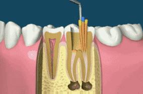 缺失牙公益广告韩国,缺失牙修复的视频