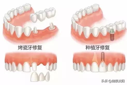 健康科普堂,健康科普堂养生