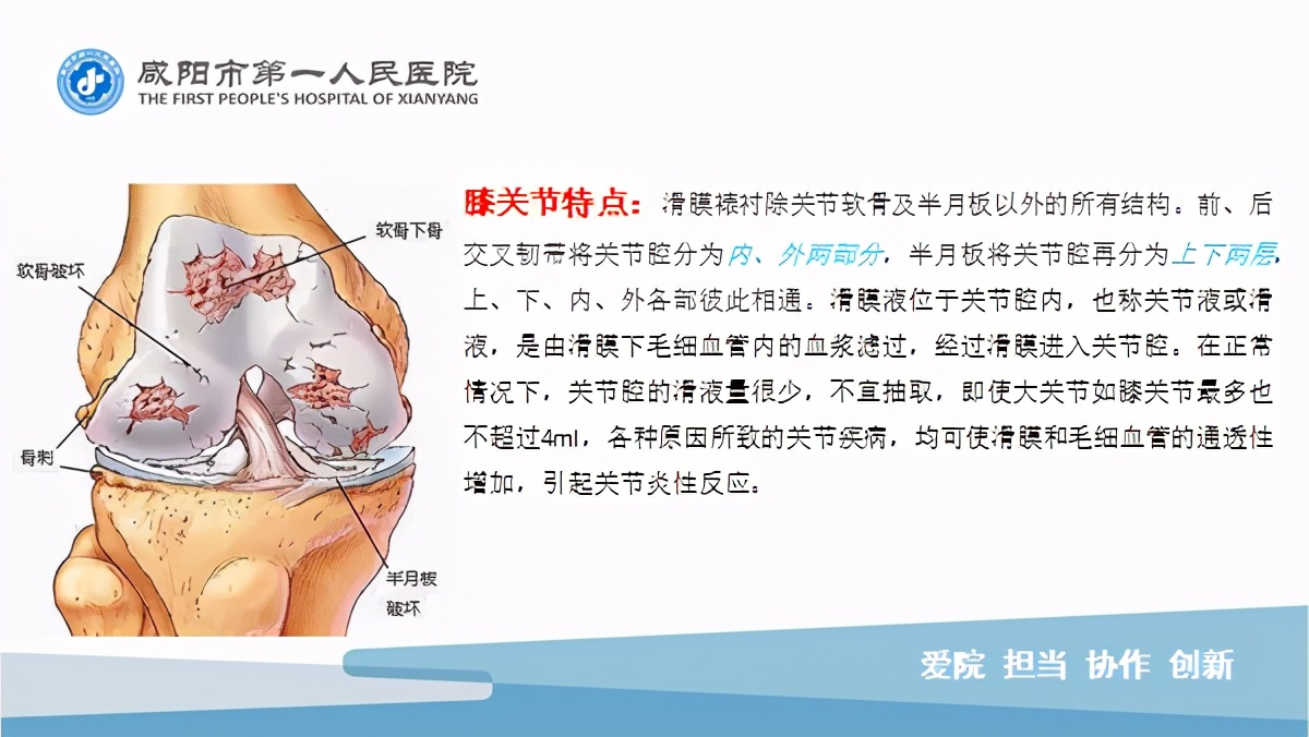 臭氧玻璃酸钠治疗膝关节炎怎么样,膝关节滑膜炎臭氧