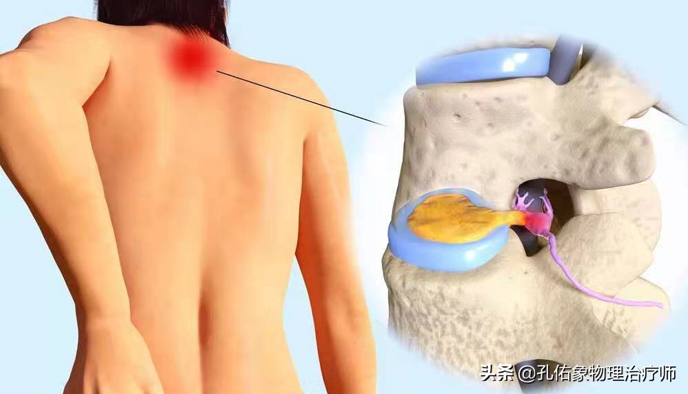 胸和肩胛骨疼痛是什么原因,右胸和后背肩胛骨疼痛是什么原因