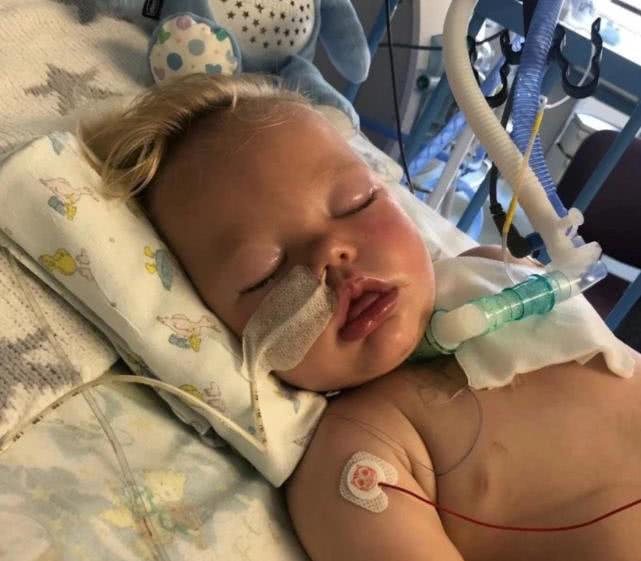 一岁宝宝被水杯砸到头部怎么办,小孩拿杯子被割伤