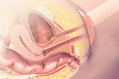 产后42天复查都检查什么挂什么科,42天产后复查必须去生产的医院吗