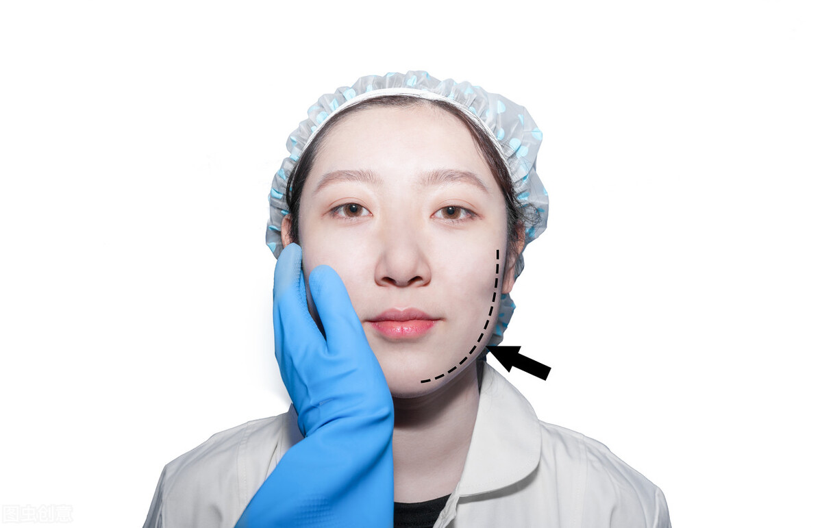 防止中年发腮的有效办法,中年人发腮怎么消除