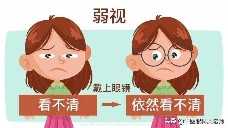 弱视重点知识,弱视治疗中的视力训练你了解多少