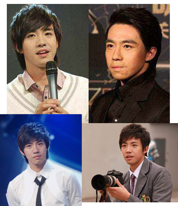 俞灏明的脸能修复吗,俞灏明的脸怎么修复的