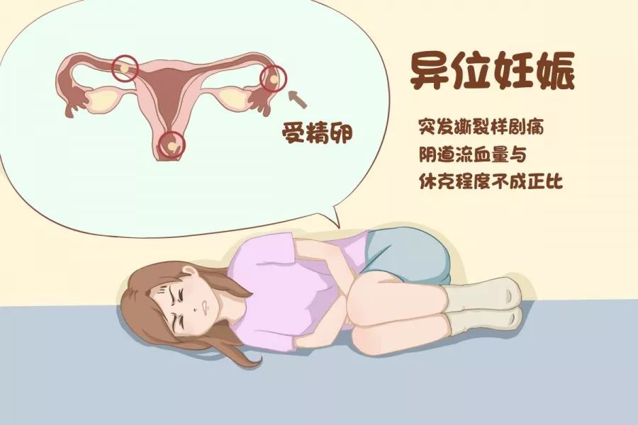 肚子疼引起休克原因,肚子痛休克严重吗