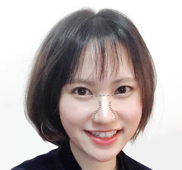 鼻型修容怎样修看着干净,蒜头鼻朝天鼻怎么修容