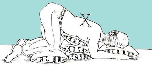 肺部支气管扩张并感染无明显症状,支气管扩张会胸痛吗还有哪些症状