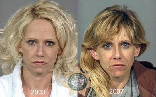 吸毒后遗症手抖治疗得好吗,吸毒后遗症会手抖