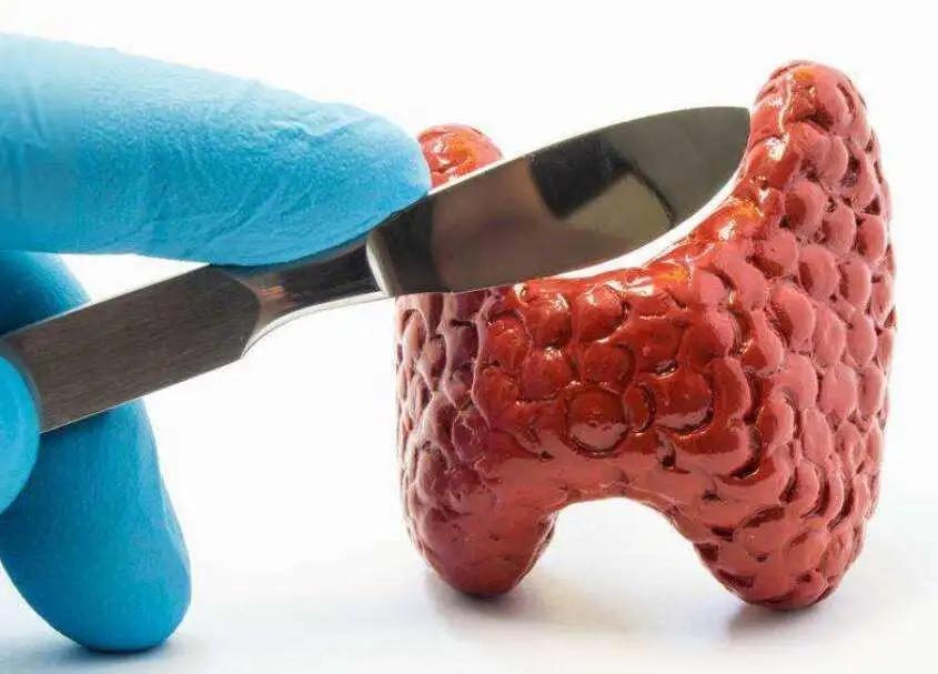 甲状腺结节脖子两侧有突起,甲状腺结节脖子出现红斑是炎症吗