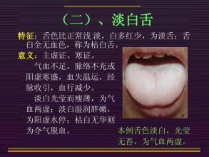 望舌知病实操完整版,教你看舌辨病
