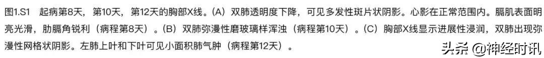 全球新冠肺炎确诊病例统计报告,全世界首例新冠肺炎确诊